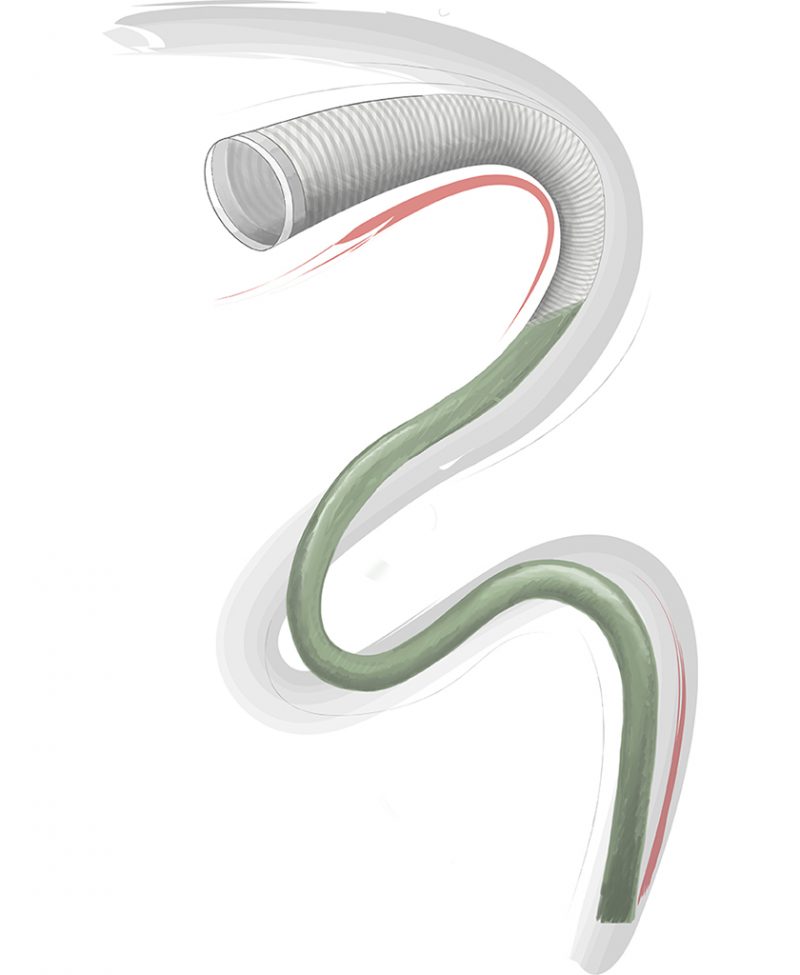 BALLAST 088 LONG SHEATH Medline Group